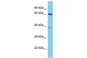 Host: Rabbit  Target Name: Vps45  Sample Tissue: Mouse Lung lysates  Antibody Dilution: 1. (VPS45 抗体  (C-Term))
