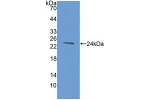 Western blot analysis of recombinant Human HAVCR2. (TIM3 抗体  (AA 22-202))