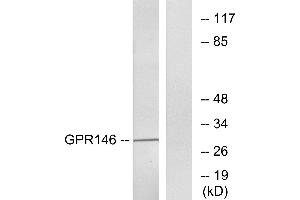 Western blot analysis of extracts from LOVO cells, using GPR146 antibody. (GPR146 抗体  (Internal Region))