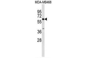 Western blot analysis of CES7 Antibody (Center) in MDA-MB468 cell line lysates (35µg/lane). (CES5A 抗体  (Middle Region))