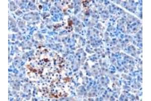 Immunohistochemistry (IHC) image for anti-Interferon Induced with Helicase C Domain 1 (IFIH1) (N-Term) antibody (ABIN2465934) (IFIH1 抗体  (N-Term))