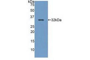 Detection of Recombinant LRP5, Human using Polyclonal Antibody to Low Density Lipoprotein Receptor Related Protein 5 (LRP5)