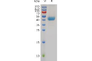 SDS-PAGE (SDS) image for Chemokine (C-X-C Motif) Receptor 1 (CXCR1) (AA 1-39) protein (Fc Tag) (ABIN6964140)