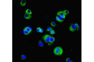 Immunofluorescent analysis of MCF-7 cells using ABIN7171040 at dilution of 1:100 and Alexa Fluor 488-congugated AffiniPure Goat Anti-Rabbit IgG(H+L) (SUSD6 (AA 144-303) 抗体)