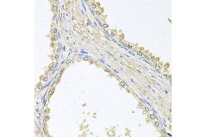 Immunohistochemistry of paraffin-embedded human prostate using PMM2 antibody at dilution of 1:100 (x40 lens). (PMM2 抗体)