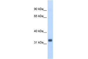 WB Suggested Anti-Ehf Antibody Titration:  0. (EHF 抗体  (N-Term))