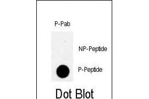 Dot blot analysis of anti-Phospho-MYT1- Antibody (ABIN389599 and ABIN2839610) on nitrocellulose membrane. (MYT1 抗体  (pThr495))