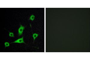 Peptide - +Immunohistochemistry analysis of paraffin-embedded human lung carcinoma tissue, using CRBP III antibody. (Retinol Binding Protein 5 抗体)