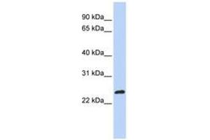 Image no. 1 for anti-MAX-Like Protein X (MLX) (AA 180-229) antibody (ABIN6744265) (MLX 抗体  (AA 180-229))