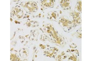 Immunohistochemistry of paraffin-embedded Human breast using Caspase-2 Polyclonal Antibody at dilution of 1:100 (40x lens). (Caspase 2 抗体)