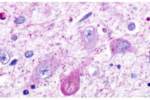 Image no. 1 for anti-Trace Amine Associated Receptor 5 (TAAR5) (Cytoplasmic Domain) antibody (ABIN1049383) (TAAR5 抗体  (Cytoplasmic Domain))