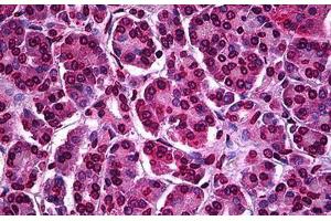 Human Pancreas: Formalin-Fixed, Paraffin-Embedded (FFPE) (ATF5 抗体  (AA 101-200))