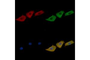 EPHA2 Mouse Monoclonal Antibody staining Hela cells by IF/ICC.