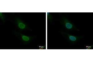ICC/IF Image CNOT8 antibody detects CNOT8 protein at nucleus and cytoplasm by immunofluorescent analysis. (CNOT8 抗体)