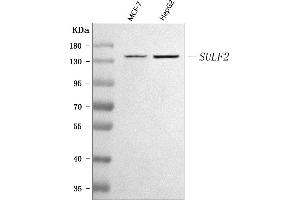 Western blot analysis of SULF2 using anti-SULF2 antibody (ABIN7601821).
