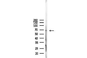 Western blot analysis of lysates from Mouse kidney, using GP Antibody at 1/1000 dilution.