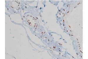 ABIN6267385 at 1/200 staining Human heart tissue sections by IHC-P. (Ezrin 抗体  (pTyr478))