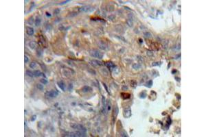 IHC-P analysis of Lung tissue, with DAB staining. (PKC theta 抗体  (AA 380-634))
