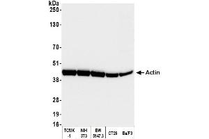 Western Blotting (WB) image for anti-Cytoskeletal Actin (CIMG_00972) (N-Term) antibody (ABIN7453904) (Cytoskeletal Actin (CIMG_00972) (N-Term) 抗体)
