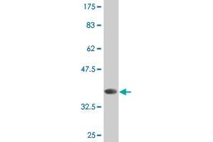 Western Blot detection against Immunogen (35. (CRMP1 抗体  (AA 221-310))