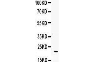 Observed bind size: 22KD (G-CSF 抗体  (AA 38-207))