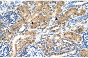 Immunohistochemistry (IHC) image for anti-Protein tyrosine Phosphatase, Non-Receptor Type 2 (PTPN2) (Middle Region) antibody (ABIN2782195)