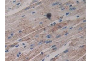 Immunohistochemistry (IHC) image for anti-Laminin, beta 3 (LAMB3) (AA 367-568) antibody (ABIN7444076)
