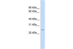 CRP antibody used at 1 ug/ml to detect target protein. (CRP 抗体  (N-Term))