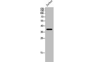 Western Blot analysis of Jurkat cells using Peropsin Polyclonal Antibody (Peropsin 抗体  (Internal Region))