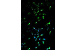 Immunofluorescence analysis of U2OS cells using STAR antibody. (STAR 抗体)