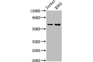 Western Blot Positive WB detected in: Jurkat whole cell lysate, K562 whole cell lysate All lanes: STIP1 antibody at 0. (Recombinant STIP1 抗体)