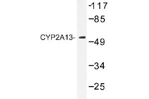 Image no. 1 for anti-Cytochrome P450, Family 2, Subfamily A, Polypeptide 13 (CYP2A13) antibody (ABIN272274) (CYP2A13 抗体)