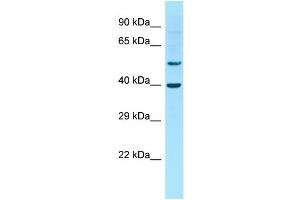 Host: Rabbit Target Name: Gja10 Sample Type: Rat Thymus lysates Antibody Dilution: 1. (GJa10 抗体  (Middle Region))