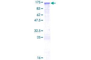 ABR Protein (AA 1-859) (GST tag)