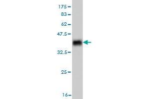 Western Blot detection against Immunogen (36. (RAB7B 抗体  (AA 100-199))