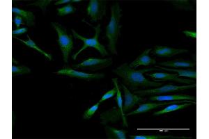 Immunofluorescence of purified MaxPab antibody to RARS2 on HeLa cell.