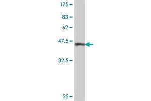 Western Blot detection against Immunogen (39. (Tuberin 抗体  (AA 540-658))