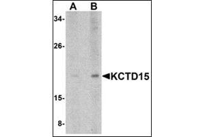 Western blot analysis of KCTD15 in human spleen tissue lysate with this product at (A) 0. (KCTD15 抗体  (C-Term))