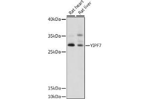 Western blot analysis of extracts of various cell lines, using YIPF7 antibody (ABIN7271420) at 1:1000 dilution. (YIPF7 抗体  (AA 1-80))