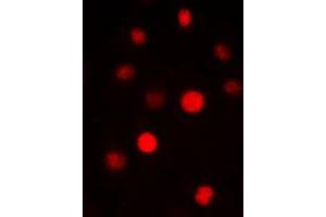 Immunofluorescent analysis of SAP14 staining in HepG2 cells. (Pre-mRNA Branch Site Protein p14 (SF3B14) (C-Term) 抗体)