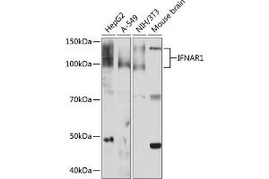 Western blot analysis of extracts of various cell lines, using IFN Rabbit mAb (ABIN1682980, ABIN3015227, ABIN3015228 and ABIN7101324) at 1:1000 dilution. (IFNAR1 抗体)