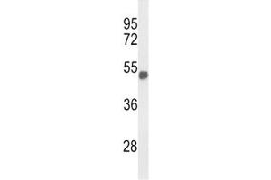 Western Blotting (WB) image for anti-Forkhead Box G1 (FOXG1) (AA 225-252) antibody (ABIN3030987)