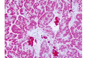 Anti-LYPLAL1 antibody IHC of human pancreas. (LYPLAL1 抗体  (C-Term))