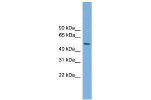 STK38L antibody used at 1 ug/ml to detect target protein. (STK38L 抗体  (Middle Region))