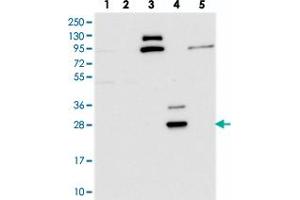 Western blot analysis of Lane 1: RT-4, Lane 2: U-251 MG, Lane 3: Human Plasma, Lane 4: Liver, Lane 5: Tonsil with CYB561D2 polyclonal antibody . (CYB561D2 抗体)