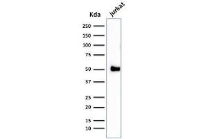 Western Blot Analysis of Jurkat cell lysate using CD2 Mouse Monoclonal Antibody (1E7E8. (CD2 抗体)