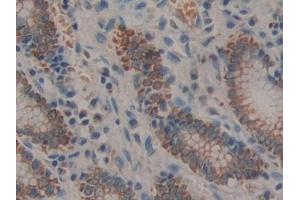 Detection of PRLR in Human Stomach Tissue using Polyclonal Antibody to Prolactin Receptor (PRLR)