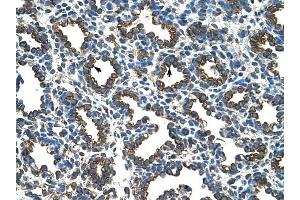 RPL8 antibody was used for immunohistochemistry at a concentration of 4-8 ug/ml to stain Alveolar cells (arrows) in Human Lung. (RPL8 抗体  (C-Term))