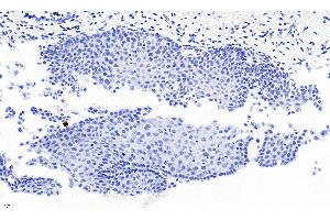 Immunohistochemistry (IHC) image for anti-Paired Box 3 (PAX3) (N-Term) antibody (ABIN185216)