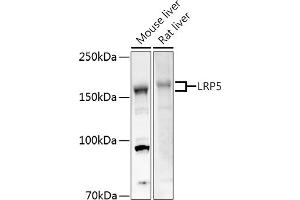 Western blot analysis of extracts of various cell lines, using LRP5 antibody (ABIN1513164, ABIN3020644, ABIN3020646 and ABIN6213630) at 1:500 dilution. (LRP5 抗体  (AA 1000-1250))